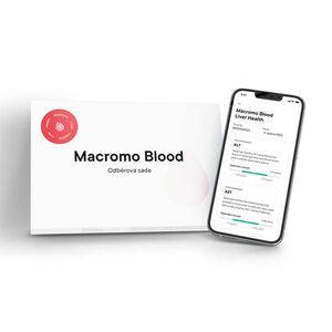 MACROMO krevní test Zdravá játra obraz