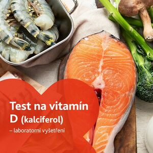 Test na vitamín D (kalciferol) - laboratorní vyšetření obraz