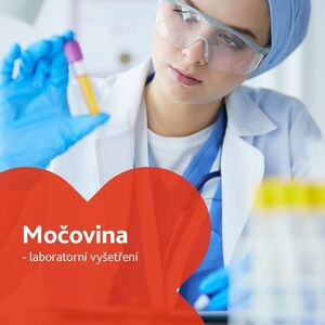 Močovina (Urea) - laboratorní vyšetření obraz