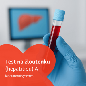 Test na žloutenku (hepatitidu) A laboratorní vyšetření obraz