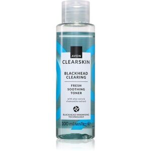 Avon Clearskin Blackhead Clearing čisticí pleťová voda proti černým tečkám 100 ml obraz